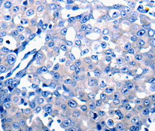 Anti-Human CCL2 Antibody
