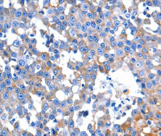 Anti-Human HINT2 Antibody