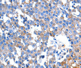 Anti-Human HINT2 Antibody - ABMIUM