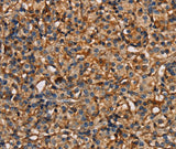 Anti-Human/Mouse PLXNA1 Antibody - ABMIUM