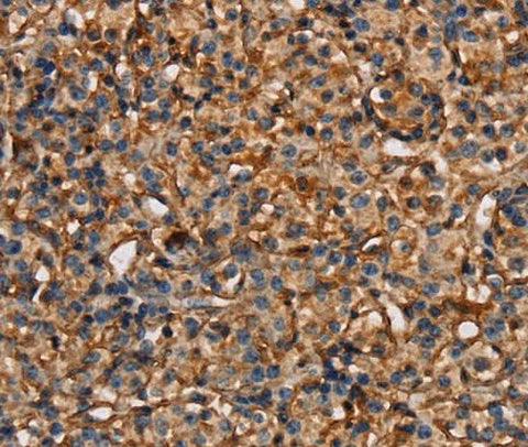 Anti-Human/Mouse PLXNA1 Antibody - ABMIUM