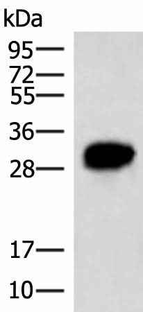 Anti-Human/Mouse HCCS Antibody