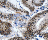 Anti-Human/Mouse LRP5 Antibody - ABMIUM