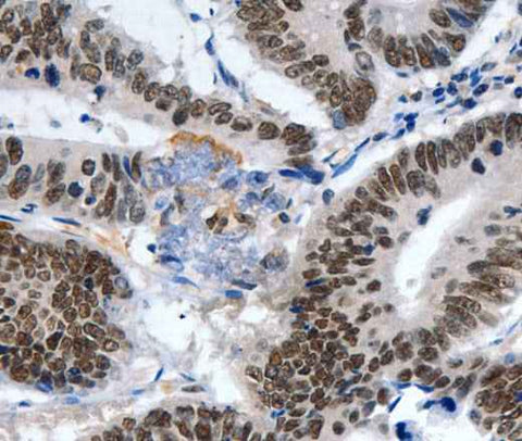 Anti-Human/Mouse LRP5 Antibody