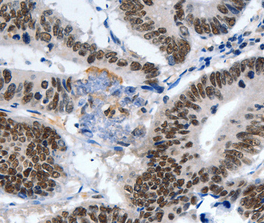 Anti-Human/Mouse LRP5 Antibody - ABMIUM