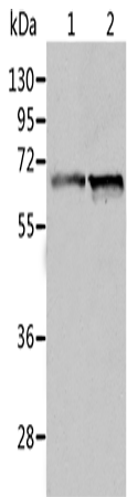 Anti-Human/Mouse/Rat ALDH4A1 Antibody - ABMIUM