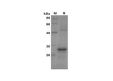 SDS-PAGE analysis of Human CCL14a/HCC-1 proteins, 2 μg/lane of Recombinant Human CCL14a/HCC-1 proteins was resolved with SDS-PAGE under reducing conditions, showing bands at 25 kDa.