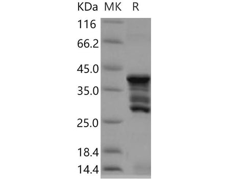 SDS-PAGE analysis of Human CD247/CD3-ZETA proteins, 2 μg/lane of Recombinant Human CD247/CD3-ZETA proteins was resolved with SDS-PAGE under reducing conditions, showing bands at 28-43 kDa.