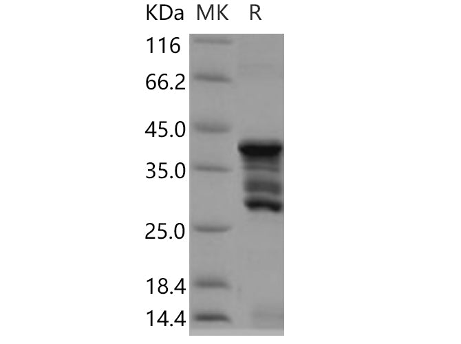 SDS-PAGE analysis of Human CD247/CD3-ZETA proteins, 2 μg/lane of Recombinant Human CD247/CD3-ZETA proteins was resolved with SDS-PAGE under reducing conditions, showing bands at 28-43 kDa.