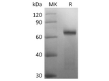 Recombinant SARS-CoV-2 Spike Protein (RBD-SD1, mFc Tag) - ABMIUM