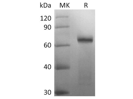 Recombinant SARS-CoV-2 Spike Protein (RBD-SD1, mFc Tag) - ABMIUM