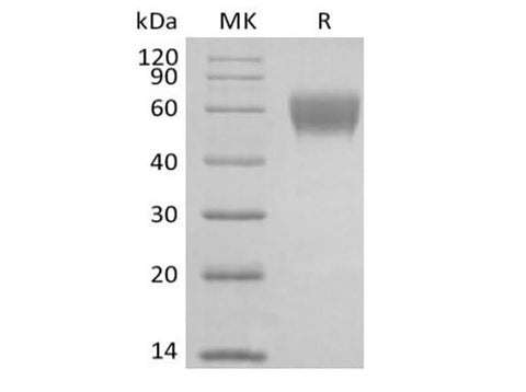 Recombinant Cynomolgus NKG2-D type II Integral Membrane Protein/NKG2D/CD314 (N-Fc) - ABMIUM