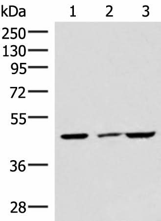 Western blot analysis of HUVEC cell Mouse brain tissue and A549 cell lysates using IP6K2 Polyclonal Antibody at dilution of 1:550