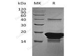 Recombinant Human EDF1/MBF1 Protein (His Tag) - ABMIUM
