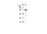 SDS-PAGE analysis of Human MAPK3 proteins, 2 μg/lane of Recombinant Human MAPK3 proteins was resolved with SDS-PAGE under reducing conditions, showing bands at 54.5 kDa.