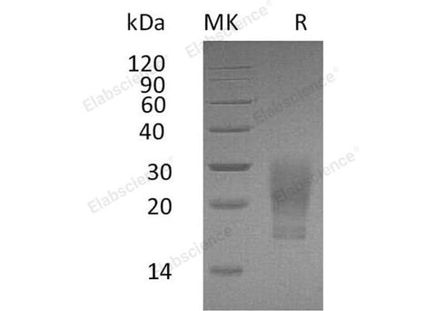 Recombinant Human GM-CSF/CSF2 Protein (His Tag, Cells) - ABMIUM