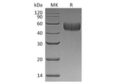 Recombinant Human SIRPB1/CD172b Protein (His Tag) - ABMIUM