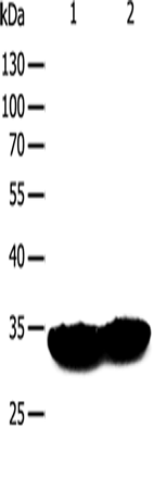 Anti-Human/Mouse/Rat TPM1 Antibody - ABMIUM