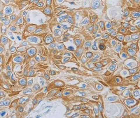 Anti-Human MC5R Antibody