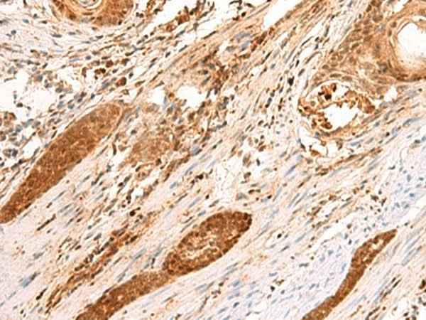 Anti-Human SCAND1 Antibody