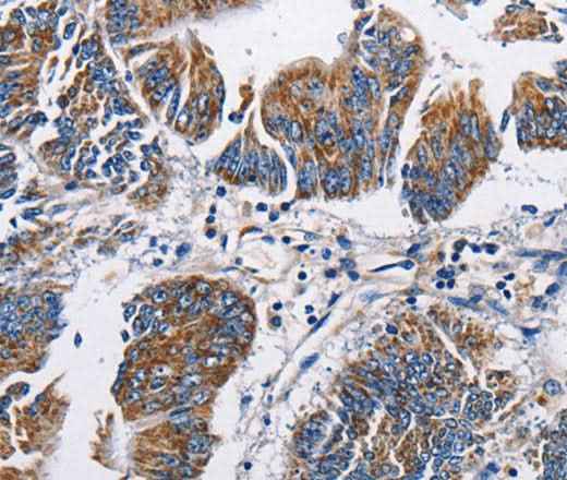 Anti-Human/Mouse/Rat NPPA Antibody