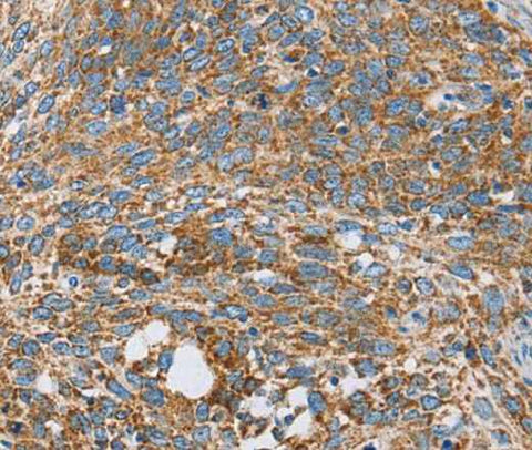 Anti-Human CENPO Antibody