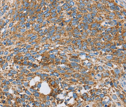 Anti-Human CENPO Antibody - ABMIUM