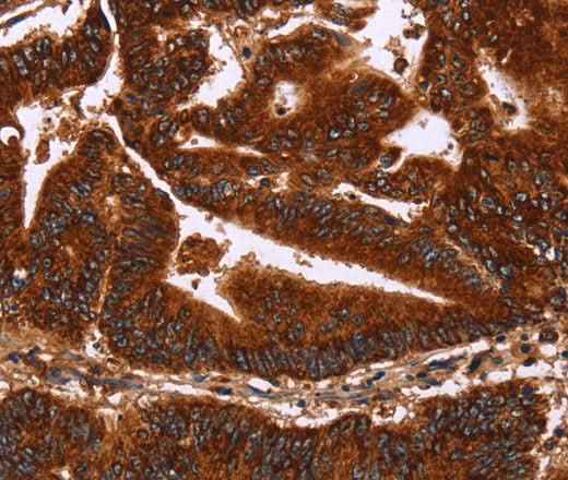 Anti-Human/Mouse/Rat GCKR Antibody