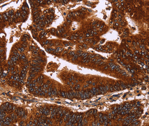 Anti-Human/Mouse/Rat GCKR Antibody - ABMIUM