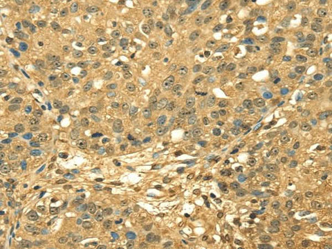 Anti-Human RPA2 Antibody - ABMIUM