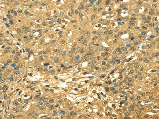 Anti-Human RPA2 Antibody - ABMIUM