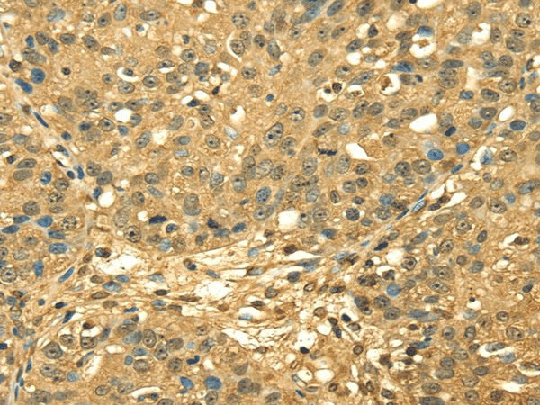 Anti-Human RPA2 Antibody - ABMIUM