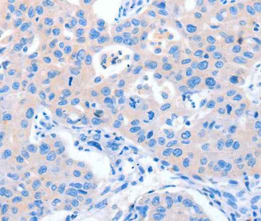 Anti-Human/Mouse NUAK1 Antibody