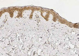 Anti-Human IL1RN Antibody [A1187] - ABMIUM
