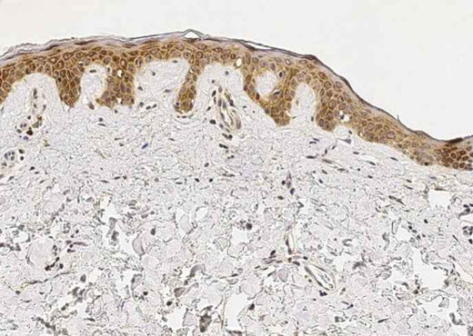 Anti-Human IL1RN Antibody [A1187] - ABMIUM