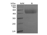Recombinant Human B7-H6 Protein (His Tag) - ABMIUM