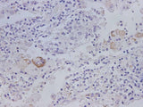 Anti-Human MMP-1 Antibody - ABMIUM