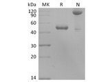 Recombinant Human BLyS/TNFSF13B/BAFF Protein (Fc Tag) - ABMIUM