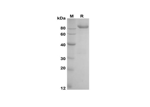 SDS-PAGE analysis of porcine HAVCR1 proteins, 2 μg/lane of Recombinant porcine HAVCR1 proteins was resolved with SDS-PAGE under reducing conditions, showing bands at 80-110 kDa.