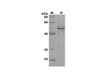 SDS-PAGE analysis of Human STAR proteins, 2 μg/lane of Recombinant Human STAR proteins was resolved with SDS-PAGE under reducing conditions, showing bands at 52 kDa.