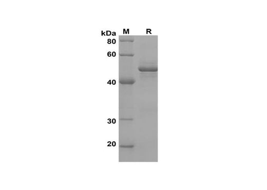 SDS-PAGE analysis of Human STAR proteins, 2 μg/lane of Recombinant Human STAR proteins was resolved with SDS-PAGE under reducing conditions, showing bands at 52 kDa.