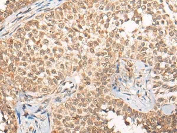 Anti-Human/Rat CABIN1 Antibody