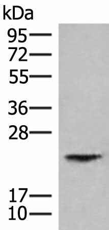 Anti-Human HEBP1 Antibody