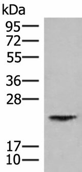 Western blot analysis of Human kidney tissue lysate using HEBP1 Polyclonal Antibody at dilution of 1:750