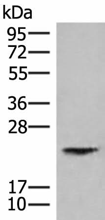 Western blot analysis of Human kidney tissue lysate using HEBP1 Polyclonal Antibody at dilution of 1:750