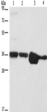 Anti-Human/Mouse ELAVL1 Antibody - ABMIUM