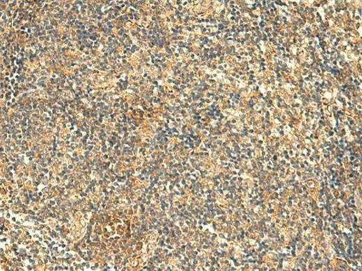Anti-Human/Mouse KIAA0513 Antibody
