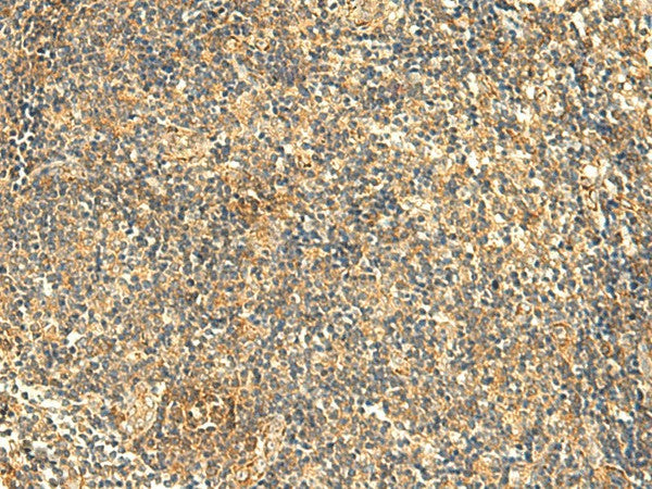 Immunohistochemistry of paraffin-embedded Human tonsil tissue using KIAA0513 Polyclonal Antibody at dilution of 1:50(×200)