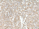 Immunohistochemistry of paraffin-embedded Human tonsil tissue using EIF1AY Polyclonal Antibody at dilution of 1:55(×200)