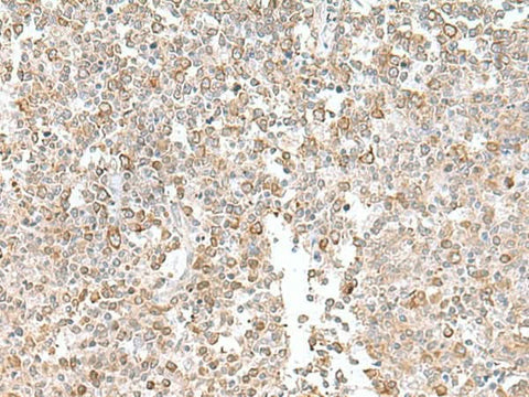Immunohistochemistry of paraffin-embedded Human tonsil tissue using EIF1AY Polyclonal Antibody at dilution of 1:55(×200)